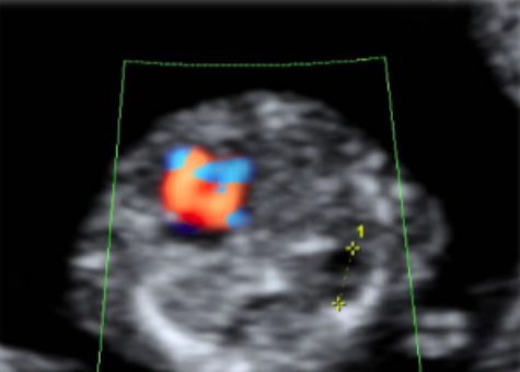GgiovaniSieo's tweet photo. Anche a maggio un nuovo caso ecografico! Per questo mese proponiamo un caso di pertinenza ostetrica: sarete in grado di formulare la diagnosi già nel primo trimestre? #SIEOGgiovani #casodelmese
https://t.co/OIoyQCSxN8 https://t.co/2sdgd1WRuH