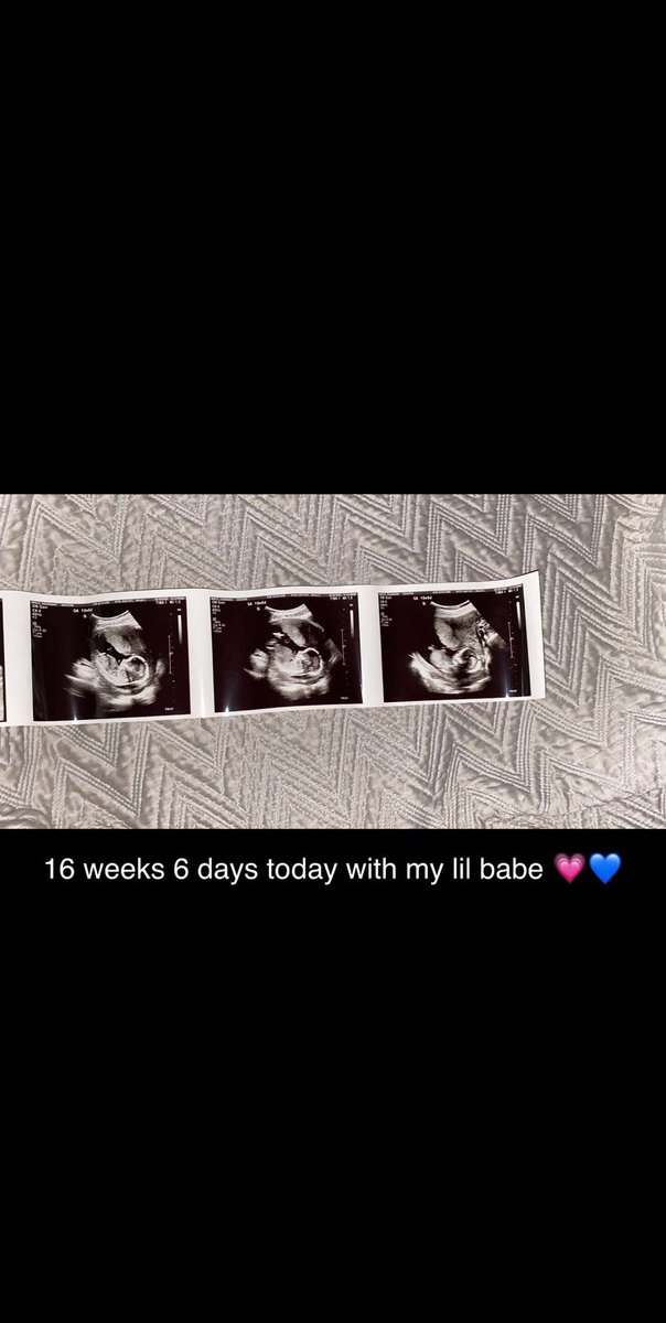 savannah_brock's tweet photo. 17 weeks today and I’m convinced my kid is gonna look just like Taylor. Already got the big ass head an all 😂 https://t.co/0HdWI0a4x3