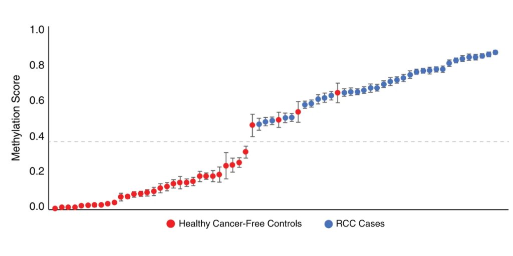Methylated DNA analysis more sensitive for detecting metastatic renal cell carcinoma than plasma cell-free DNA analysis go.nature.com/2WSumZO #genetics #cancer