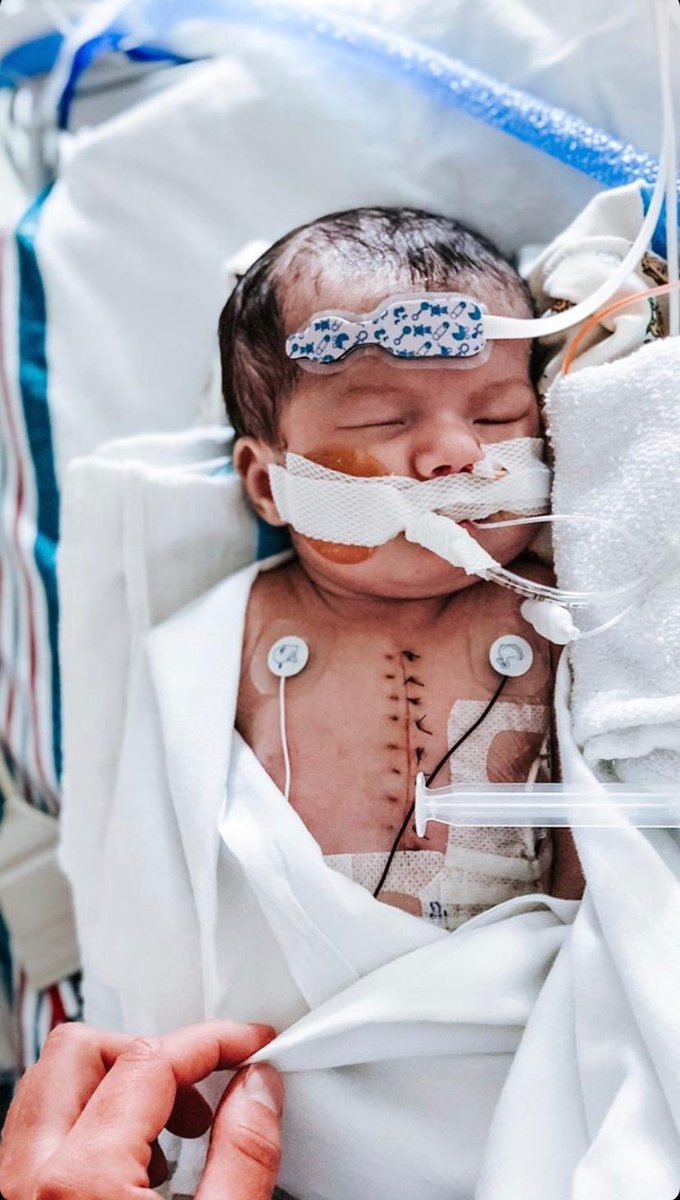 TheJPLopes's tweet photo. Friends, I’m not one to make requests, but would you take time to lift up little Helen in prayer? She’s had incredible challenges: bleeding in brain, fluid in lungs, open heart surgery... but she’s fighting. Thank you! Her brother is one of my wife’s Pre-school students. https://t.co/OPBAHaiSuW