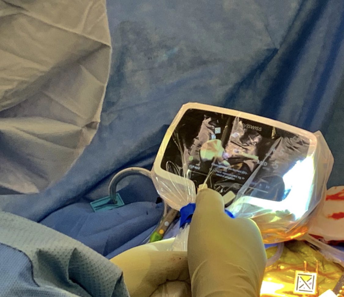 FrancoisPi3naar's tweet photo. Another successful posterior approach utilising Naviswiss Hip Navigation today. 

#naviswiss #hipnavigation #navigation #activesurgical https://t.co/Npg09sy4eu