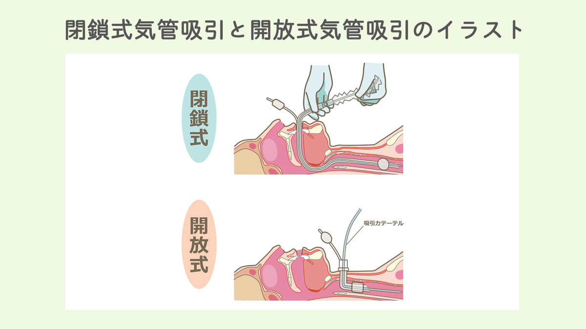 【看護師?イラスト集】では、看護師のみなさんからのイラストアイデアを大募集中!?✨

あなたのアイデアがイラストになるかも?!?

みなさんのアイデアがどんなイラストになったのかはこちらから確認できます?❤
https://t.co/xnAxGPeAVe

随時イラストを作成中✏️?お楽しみに～?♪ 