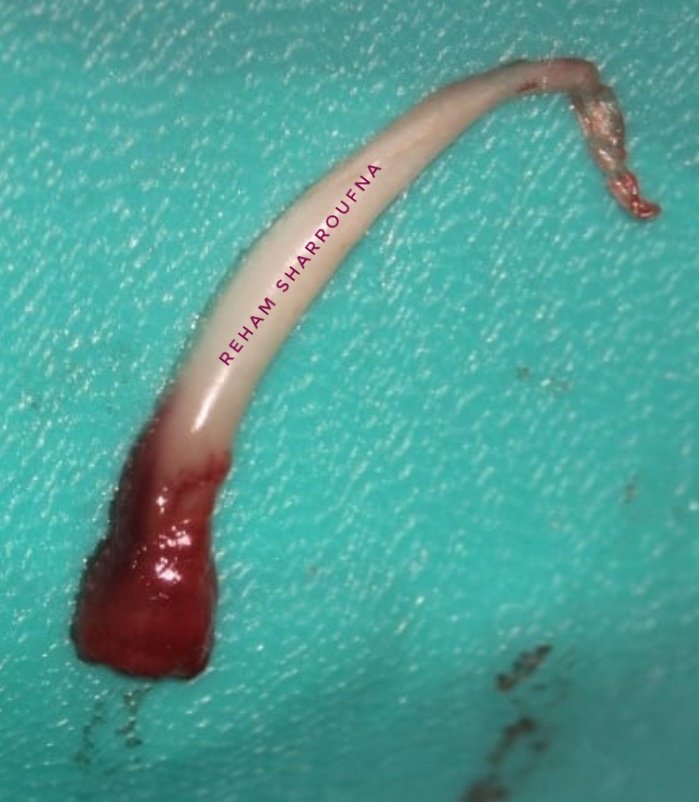 Rehamsharroufna's tweet image. من أجمل الصور اللي إلتقطتها تحت المجهر #عصب_الأسنان مكبر عدة مرات

#اللي_ما_ينومكم_الليل