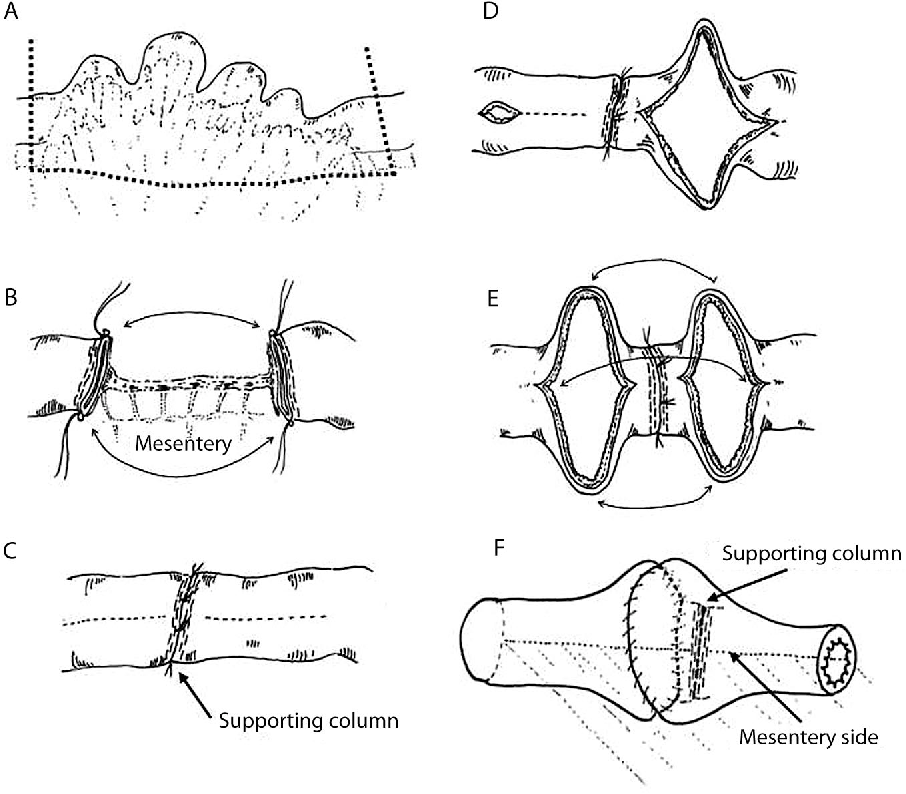 Colorectal Disease tweet media