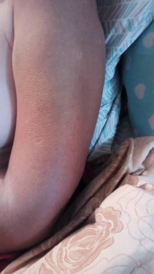 aixagar90086508's tweet photo. mi nombre es Aixa tengo 60 anos vivo en Venezuela actualmente estoy pasando una situación fuerte me caí en mi casa y me fracture el humero actualmente no cuento con los recuersos para operarme de emergencia espero me puedan ayudar para colocar el tutor que necesito o difundiendo https://t.co/hstCczWqnZ