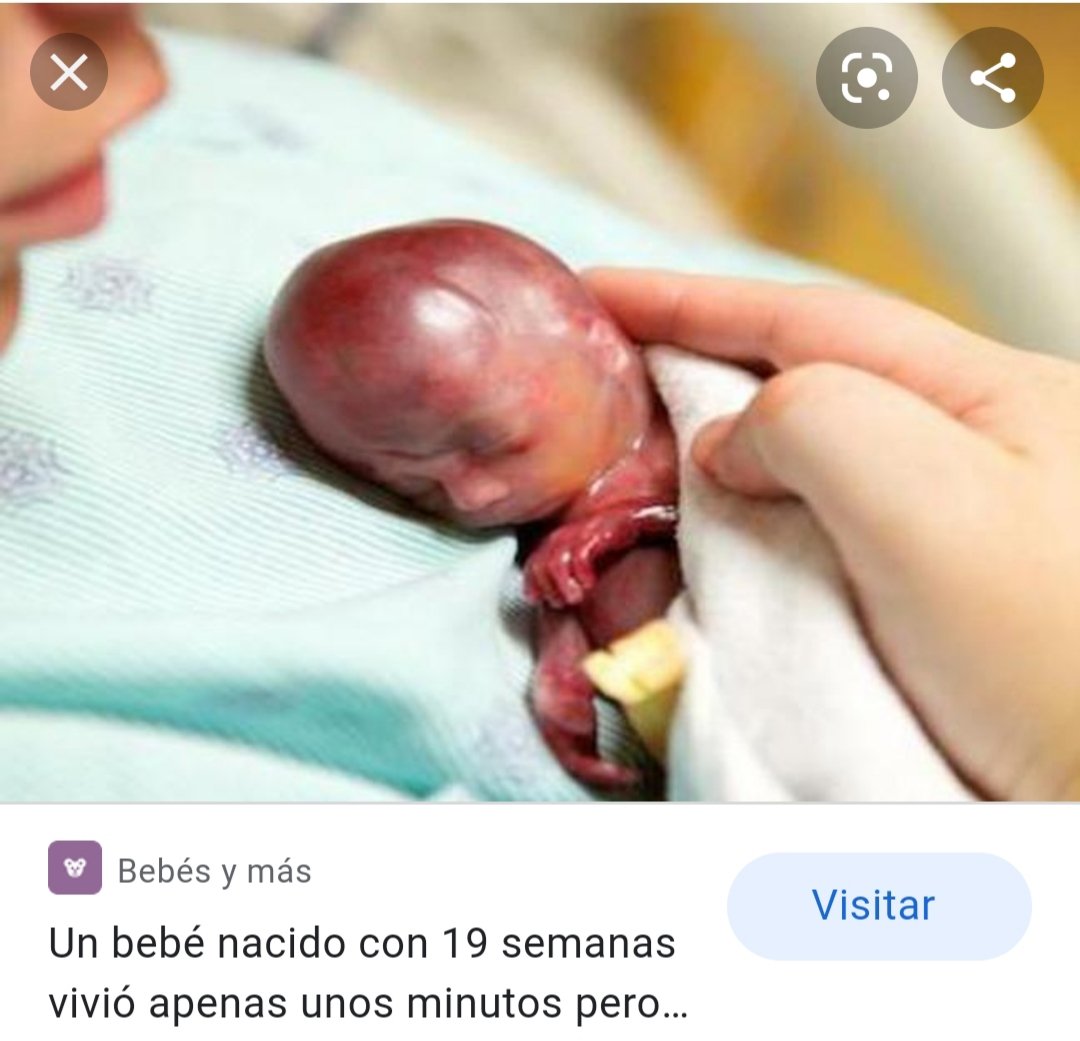 paticornago's tweet photo. @Gemma_odan @montse_alonso2 @DavidDamian94RF @alwayscepeda1 @cepedaoficial Esto es un bebé con 19 semanas de gestación si crees que esto es un conjunto de células sin más y no un ser humano..
Desde el momento de la fecundación se empieza a formar un ser humano distinto que dependa de la madre para gestarse es otra cosa y no lo digo yo lo dice la ciencia https://t.co/PXBILLAGXv