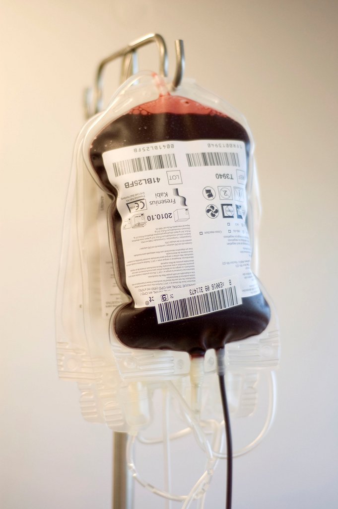 II / quels produits consomment les footballeurs ? 1) Le dopage sanguin la transfusion sanguine est souvent réalisée en Suisse, l'athlète change complètement son sang pour optimiser ses performances. le but?Augmenter la quantité de globules rouges ( meilleure endurance).