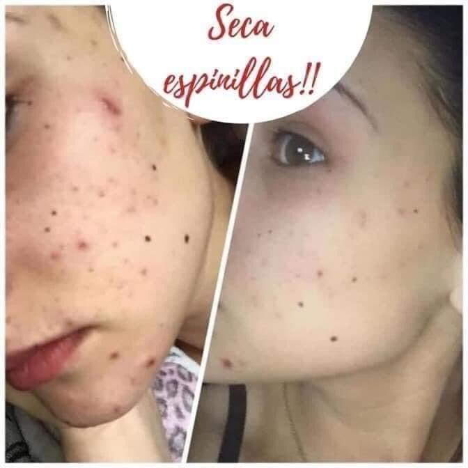 CueDec's tweet photo. Quieres aclarar y despercudir zonas del cuerpo!
Sufres de manchas por el sol en cuello o peor aún  espinillas en alguna parte de cuerpo o rostro⁉
 Con esta BARRA PULIDORA es posible eliminar todo eso❗

reaviva el color de los tatuajes  😍
Limpia las brochas del maquillaje https://t.co/URqv9VmsQV