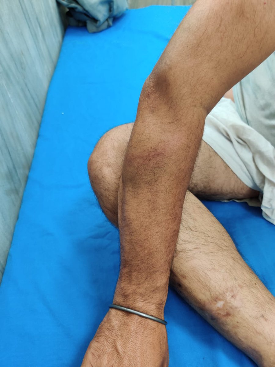 psgazi's tweet photo. #Mohali Based Senior #Punjabi #Journalist #MajorSingh brutally thrashed by @PunjabPoliceInd ASI #OmParkash. Major Singh said that he was at Phase 4 Gurdwara Sahib for coverage. ASI first snatched his equipment, then police picked him up &amp; brought to PS where he was beaten by ASI https://t.co/q9wFAFTNVL