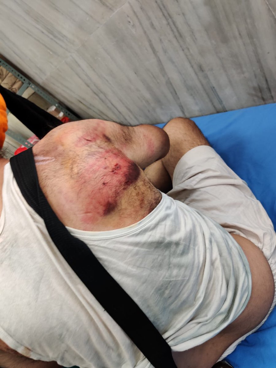 psgazi's tweet photo. #Mohali Based Senior #Punjabi #Journalist #MajorSingh brutally thrashed by @PunjabPoliceInd ASI #OmParkash. Major Singh said that he was at Phase 4 Gurdwara Sahib for coverage. ASI first snatched his equipment, then police picked him up &amp; brought to PS where he was beaten by ASI https://t.co/q9wFAFTNVL