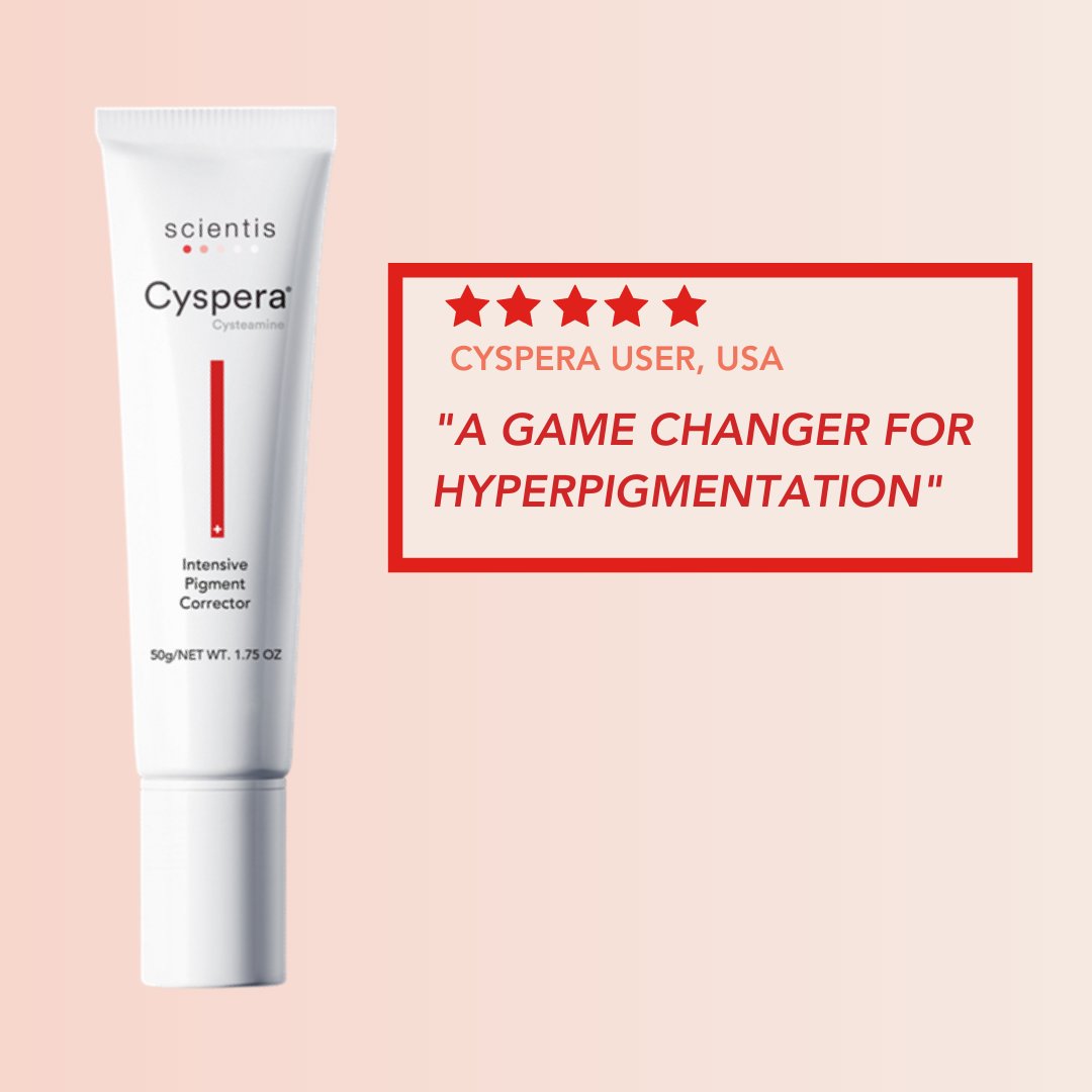 “Was on #hydroquinone on and off for several years and although I managed to lighten my #darkpatches, as soon as I stopped the hydroquinone, the dark patches returned. #Cyspera is a game changer. True science behind how it works. cyspera.com/science-behind/