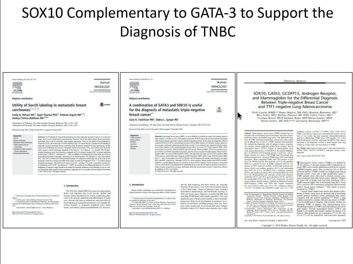 AdelinaBaltan's tweet photo. This blew my mind. I have to do some reading. π€ Thank you, @IHC_guy and #CAPVirtualPath ! #immunopath https://t.co/SlBvGHiaWy