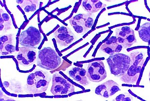 I joked about this once so here it is...Lizzo as microbiology stains!Let's start with the common gram stains.Crystal Violet is often used to determine gram positive cells which have a thick peptidoglycan layerInspired by  @lizardwithaz (post linked at end of thread) 1/9