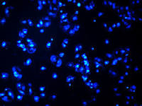 DAPI is a stain which attaches itself to double stranded DNA. It is generally used to help visualize all bacteria present, while a second color is used to stain specific organisms. 4/9