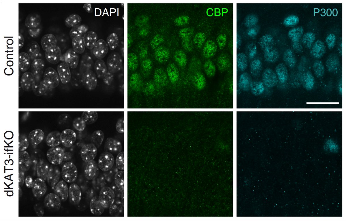 In a first such study, we found that KAT3 proteins (CBP and p300) are not only important for the development of the nervous system, but the continuous expression of at least one of them is necessary to keep the neuronal identity intact (3/11)