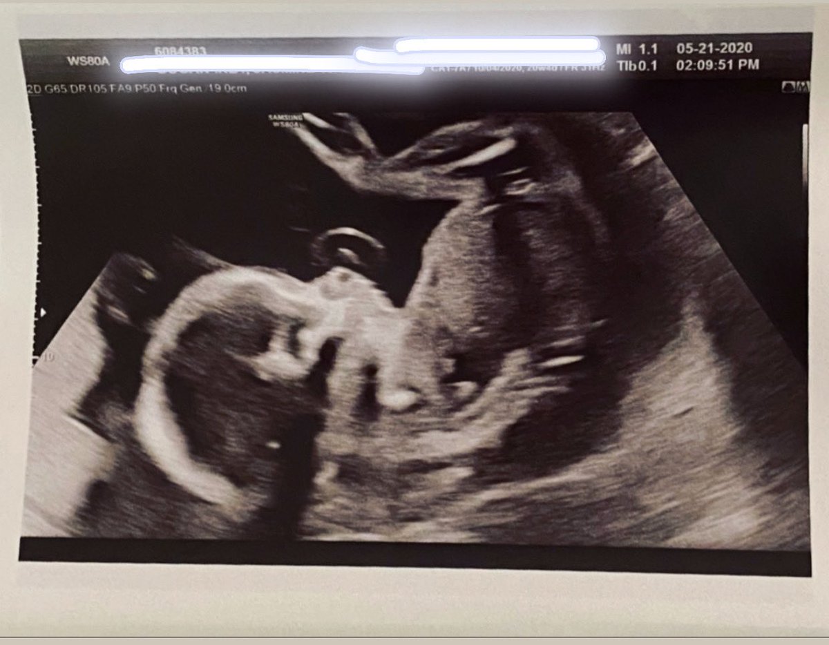 _Zah1600's tweet photo. it’s a boy 💯 Baby Za 💙 https://t.co/kjj1JMiOwm