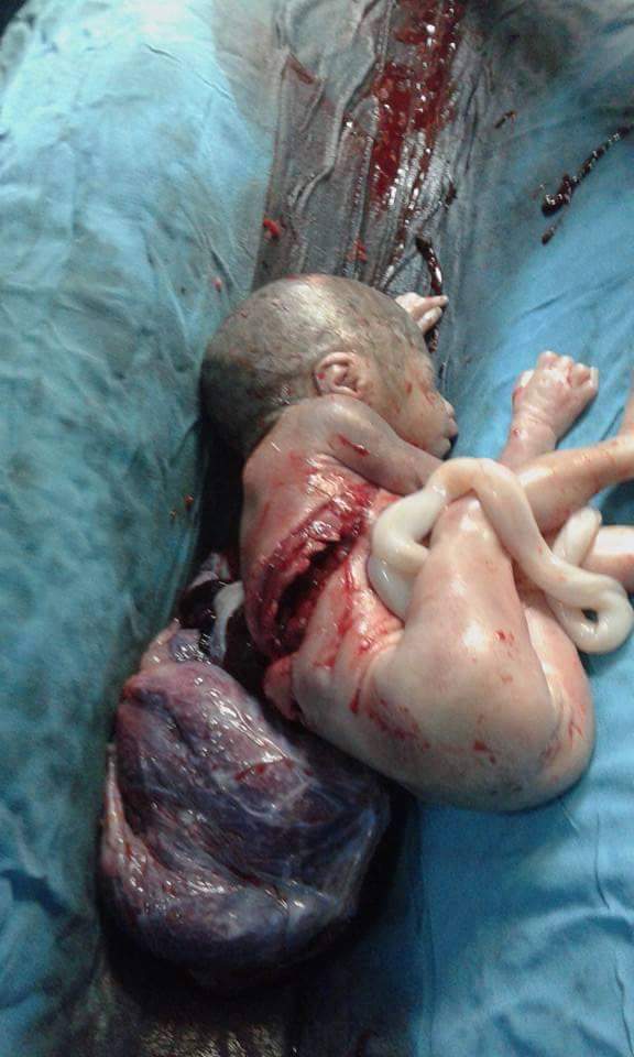 HaithamGhoniem's tweet photo. +18
الصورة ده نموذج لبطولات قوات إنفاذ القانون من الجيش والشرطة في #سيناء، وقصة الصورة تعود لتاريخ الثلاثاء 29 مارس 2016 عندما قامت قوة للجيش المصري متمركزة بكمين جنوب الشيخ زويد بإطلاق النار على سيدة حامل في الشهر السابع قرب منزلها اثناء جمعها بعض الأعشاب لأغنامها.

(1/3) https://t.co/drcXqUfG0s
