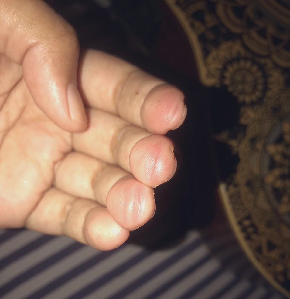 desyeris's tweet photo. Susah banget sih main gitar. Sakit semua jari ☹️ https://t.co/iHYQS5rU7p