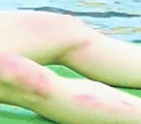 ผิวน้องดูบอบบางมากเลย นิดเดียวก็ขึ้นสีแล้วㅠㅠㅠㅠ