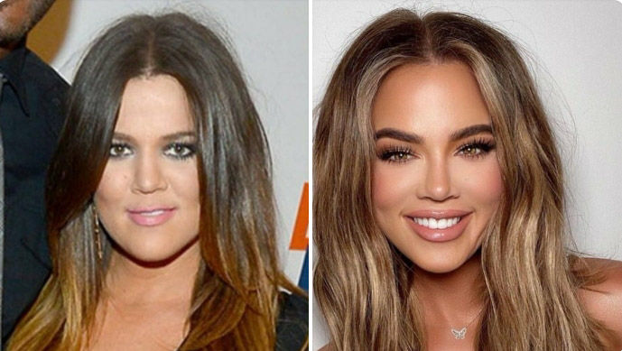 bellethewinebae's tweet photo. Here is Khloe Kardashian taking Arya Stark's skill of changing faces to a whole new level. Maybe it's Photoshop. Maybe she has truly fucked her face. 🙆🏽‍♀️ https://t.co/YVZnsVTYRr