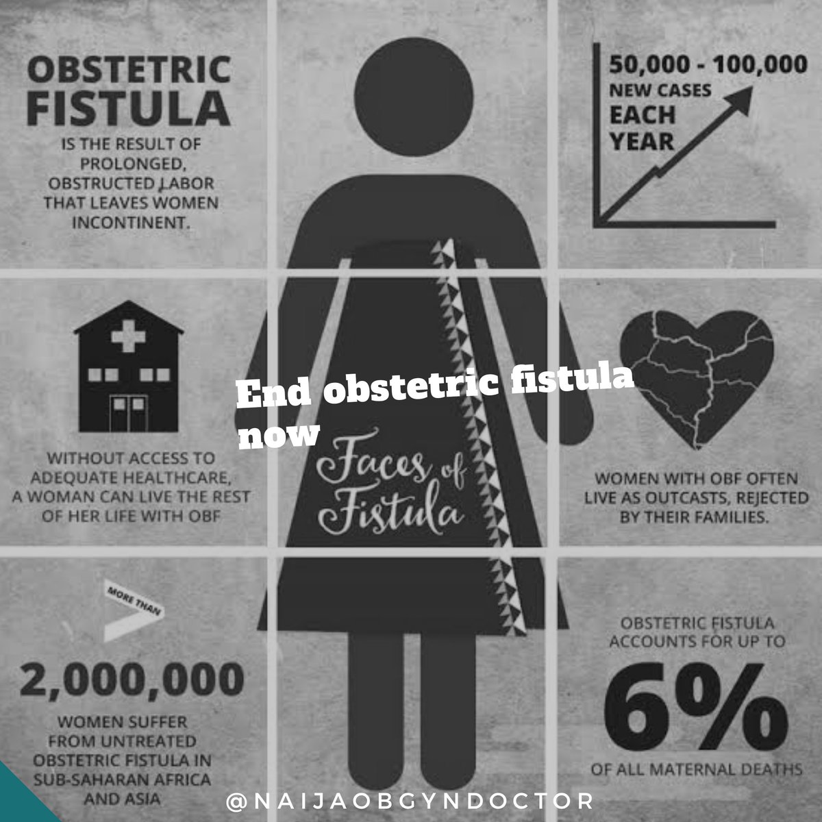 SoftLifeGynae's tweet photo. Every 23rd May, Obstetric fistula takes centre stage 

This  condition is one of the most serious and tragic injuries that can occur during childbirth.

It is a hole between the vagina &amp;  bladder/ rectum which causes them to leak urine or faeces. 

ATHREAD
A case I saw once https://t.co/GX7e5doHOL