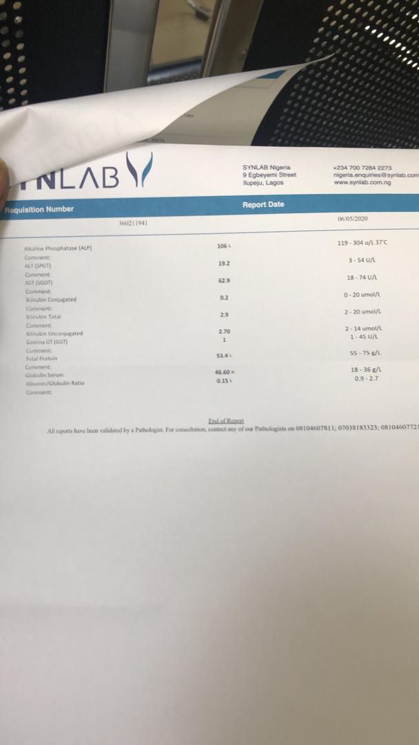 adisa_adedapo's tweet image. Find attached result from the blood work

What is/are Dx?  And why

What further Test(s) should carried out? Why

What treatment line should be followed? Why