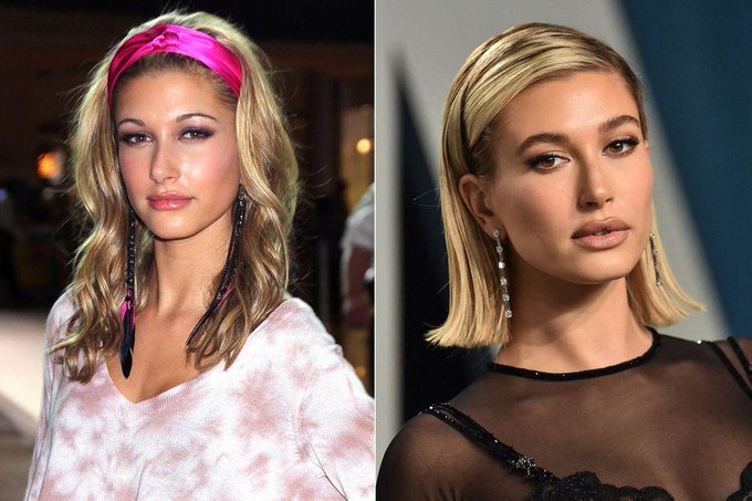Hailey Bieber Chirurgie