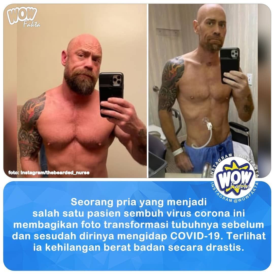 kontenwow's tweet photo. Mike yang dulunya bertubuh #atletis kini tampak sangat #kurus . Virus #corona SARS-CoV-2 (penyebab penyakit COVID-19) telah menggerogoti tubuh pria 43 tahun itu setelah ia menjalani perawatan di rumah sakit selama enam pekan...⤵
.
https://t.co/tVsCqRRPrE
.
. https://t.co/97tXfp6sx5