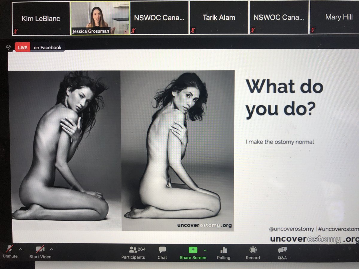 NSWOC's tweet photo. We are so so pleased to have Jessica Grossman, founder of Uncover Ostomy, sharing her "Empowering Talk" this morning LIVE on Facebook and Instagram! We hope you are all enjoying her inspiring story and message. #VirtualNSWOC https://t.co/uUjye9LZTf