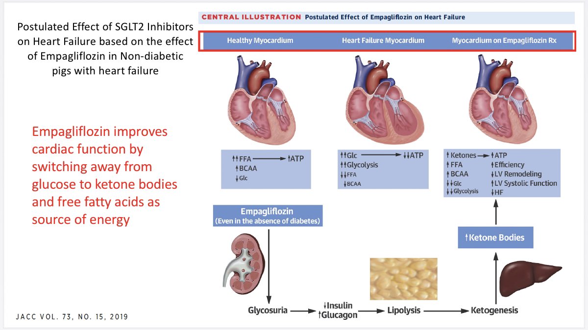 How do SGLT2i improve CV outcomes? Possibly due to: in Preload (diuretic effect) in Afterload ( BP) Improvement in Cardiac Bioenergetics by switching from glucose to ketone bodies as source of energy Na/H Exchange in the 18/