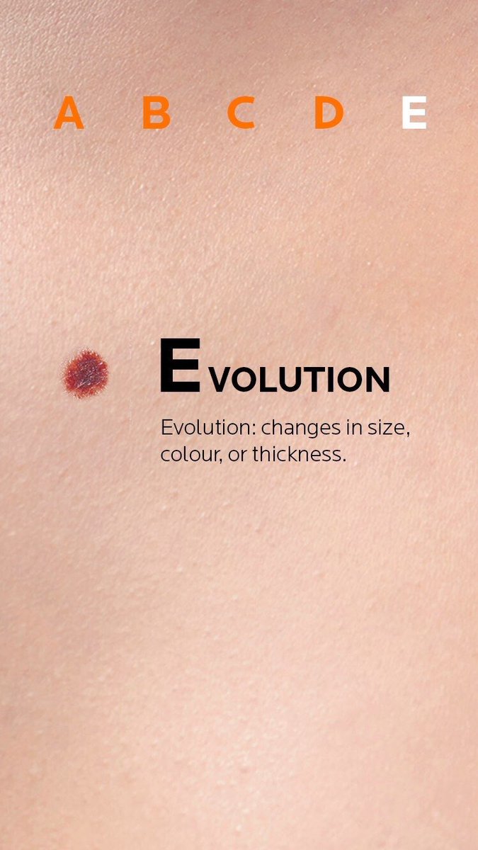 dermatologia30's tweet photo. E⃟V⃟O⃟L⃟U⃟C⃟I⃟O⃟N⃟ @pielsana_aedv @aedv_es @EuroMelanoma @LaRochePosay_ES https://t.co/WrnAeFXGOC