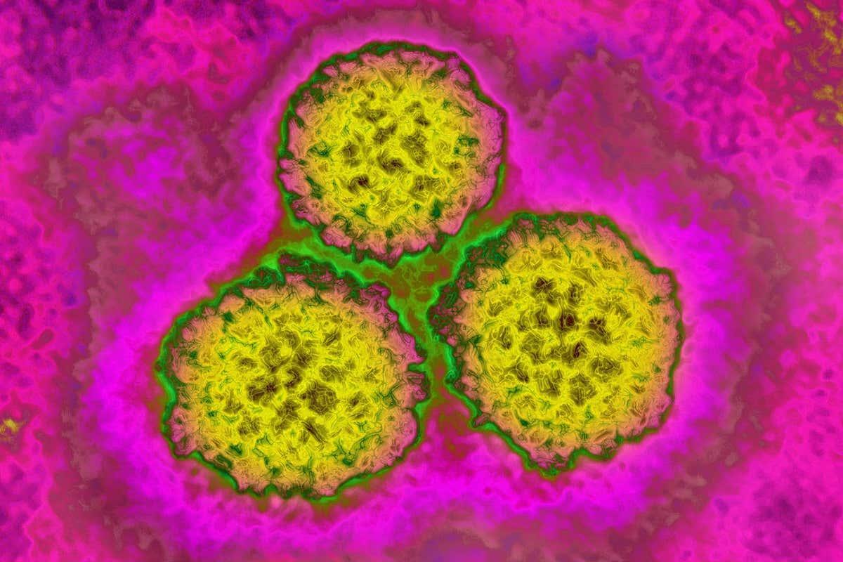 newscientist's tweet photo. An estimated 2000 premature births have been prevented by widespread HPV vaccination in Australia, possibly by protecting against damage to the cervix https://t.co/5j1e1GpJmD https://t.co/oNNCOzJ6YI