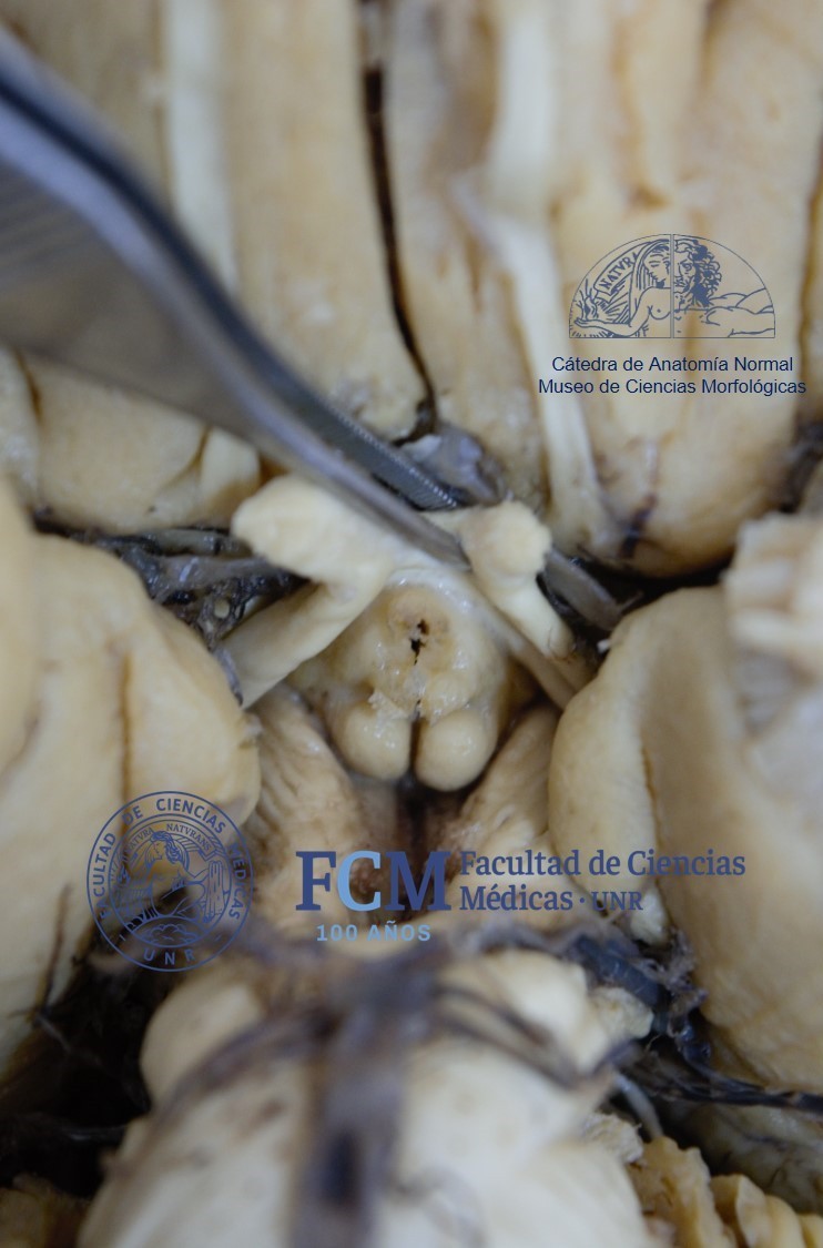 anatomiafcmunr's tweet photo. 💀Mas imágenes de DISECCIONES CADAVÉRICAS ‼️ Fueron realizadas por el Departamento de Neurociencias de Nuestro Museo💀 https://t.co/IJqTmhK8z1
