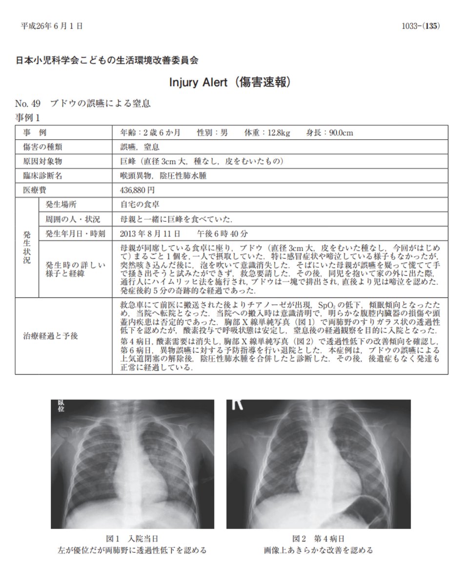 育児雑誌に スーパーボールを使ったお風呂での遊び が掲載されていたがとても危険なのでやらない方が良さそう 3歳過ぎても誤飲する Togetter