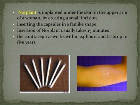 By 1988, The Rockefeller Foundation reported progress on this including Norplant (developed by Rockefeller) which includes a under the skin implant lasting for 5 years that causes sterilization. Later on The Population Council along with W.H.O. joined in...
