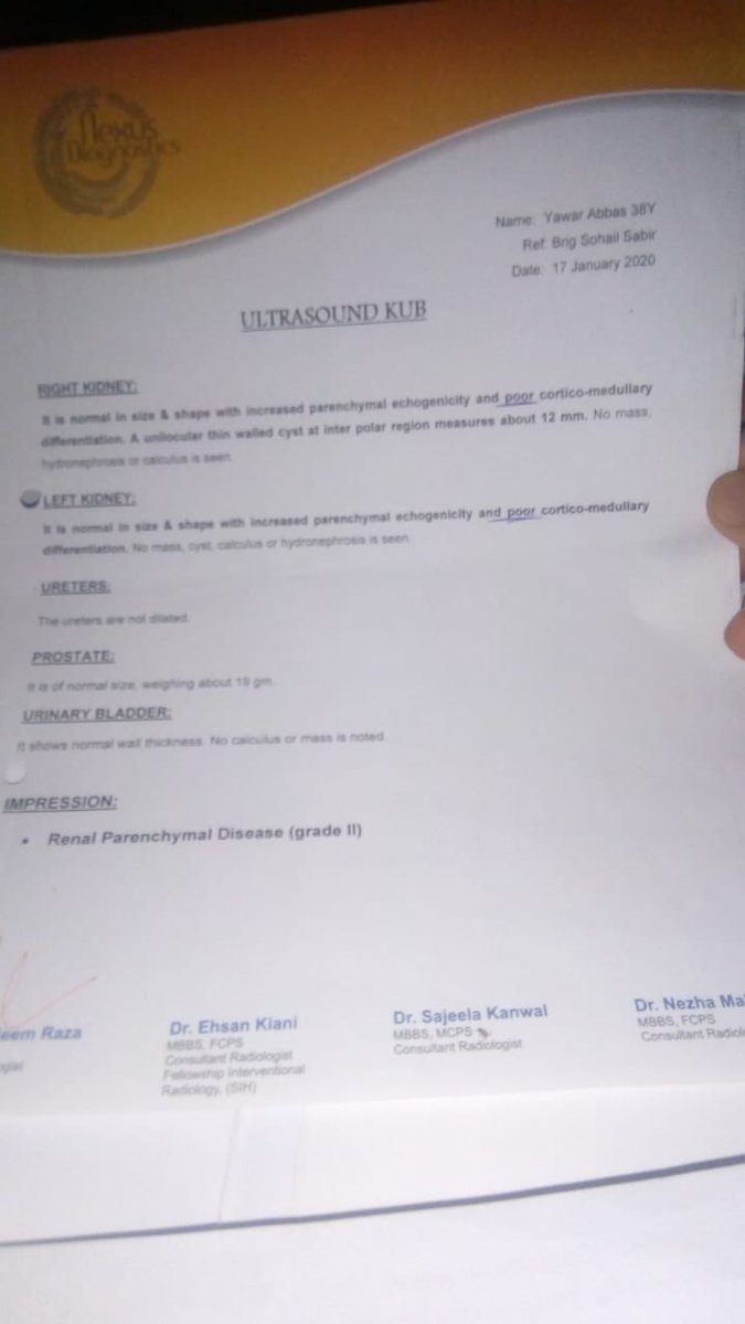 AmirMateen2's tweet photo. This patient has 5 kids and needs help for kidney transplant. His cousin is giving him kidney but he needs monetary help for operation. Pl contribute: Allied bank gilgit main branch code 0578 Acc# 0010070199240011
Account title
 yawar abbas https://t.co/oQyvfv1rni