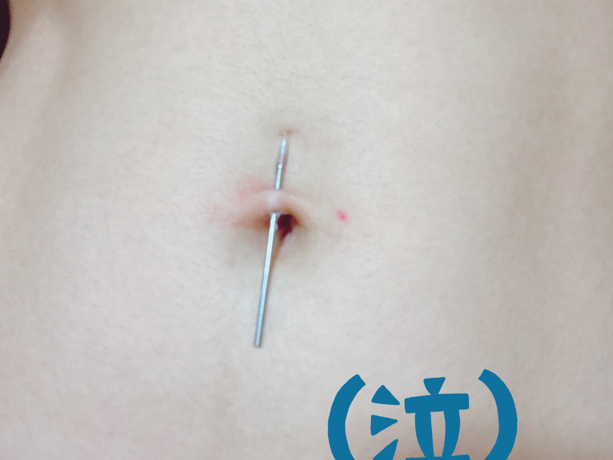 Mai へそピ開けたんだが 斜め過ぎてやり直そうとしたら 死んだ ファーストピアス入らん ただ穴開けただけ笑 へそピってなんでこんなにすぐピアスとおらんことなるん 誰か開けて笑