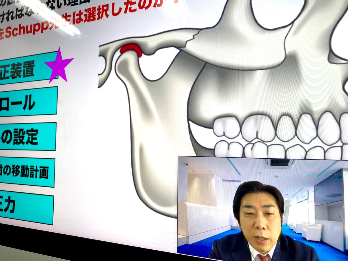 アライナー矯正6回コースのオンライン講座。本日は『CMDの講義』です。
尾島 賢治先生のアライナー矯正治療6回コース:
digitalalignerorthodontics.com/seminar_in_202…
#インビザライン, #アライナー矯正, #尾島賢治