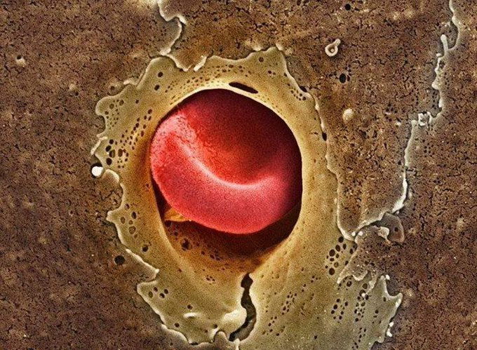 BIOEAF's tweet photo. Erase una vez la vida debía de ser de obligado visionado. Un eritrocito pasando por un capilar, imagen real y representación de la serie infantil https://t.co/k79gZCK82D
