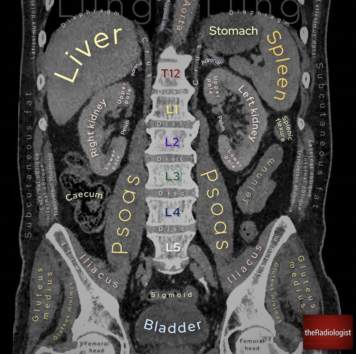 Abdominal CT Scan Anatomy