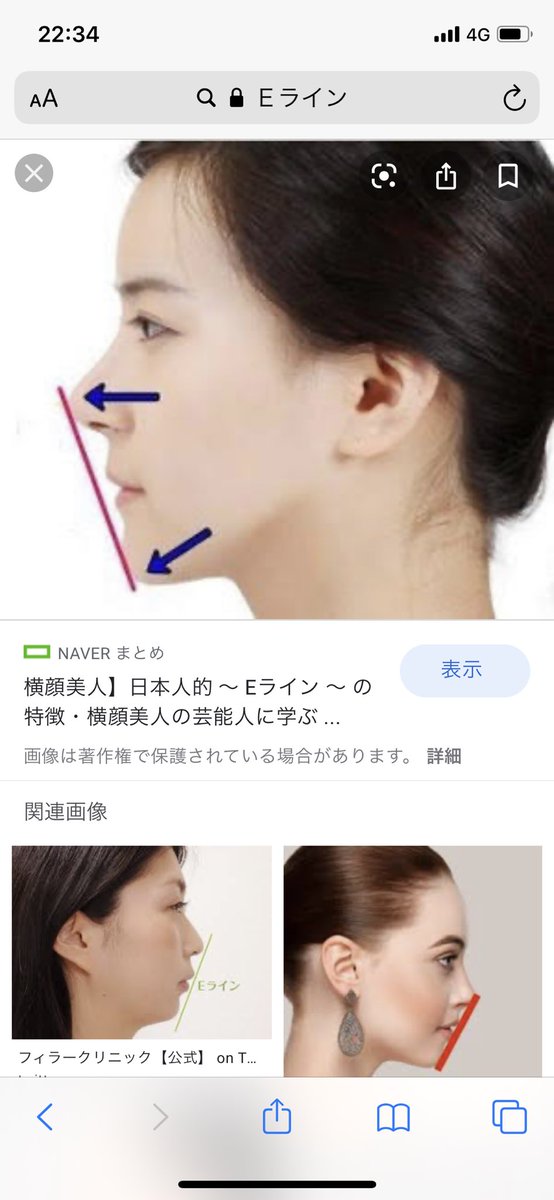 いかのおすし Ad 唇デブだから 通常時こんなんやぞ しゃくれとるし いかのおすし Ad 唇デブだから 通常時こんなんやぞ しゃくれとるし