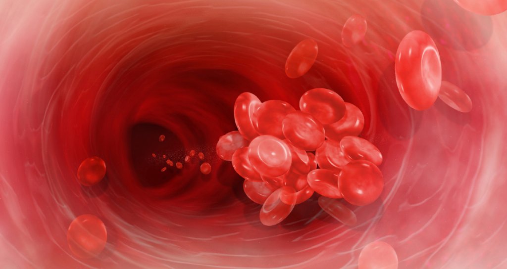 In addition to the well-known breathing problems, blood clots are a significant danger for COVID-19 patients. What you need to know: wb.md/36cuoig