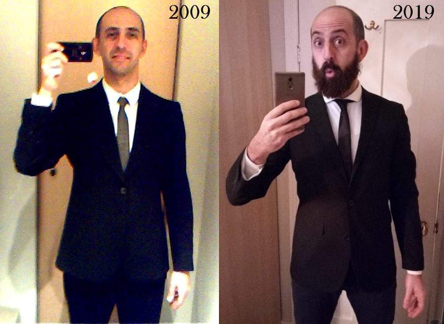 Do I look better now or #10years ago? #challenge #BetterSkin #BetterDays #yearsandyears #LookAtHerNow #beauty #beautiful #BEARD #bearded #BEARDS #beardgayguy #gennyrandom #selfie #SelfieSunday #selfies #suitman #SUITS #suit #oldbutgold