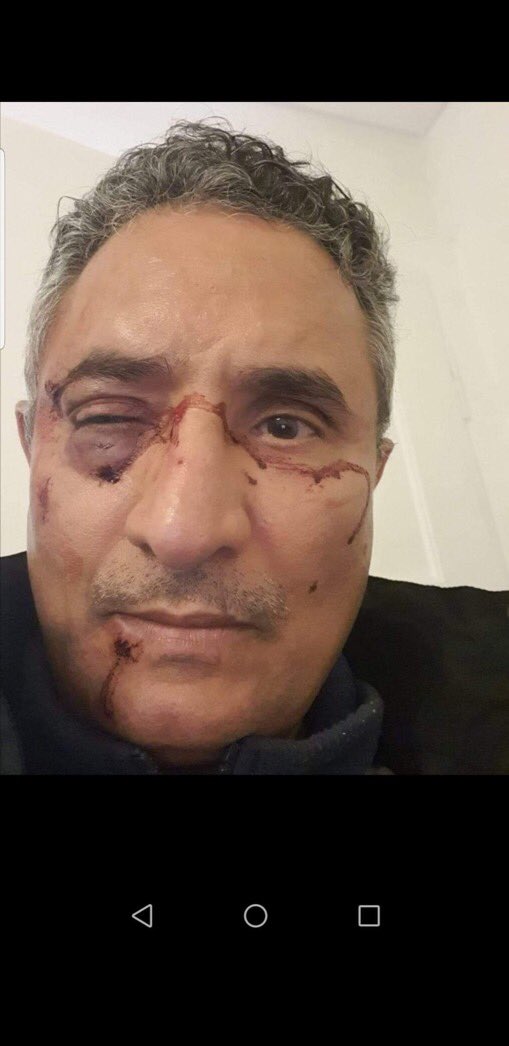_iii2ei's tweet photo. لكل أبناء اليمن شمالا وجنوبا؛
رجاءا عمموا الهشتاج فالرجل ثروة قومية للأجيال ليس للجنوب وانما لليمن كاملا لما يملكه من ذكاء خارق فهو استاذ الحاسوب و تكنولوجيا المعلوماتية والاتصالات الاول في اليمن ..
حرام يا عالم حرام والله 😭
#انقذوا_الدكتور_يحي_الريو�� https://t.co/WMAIxMf719