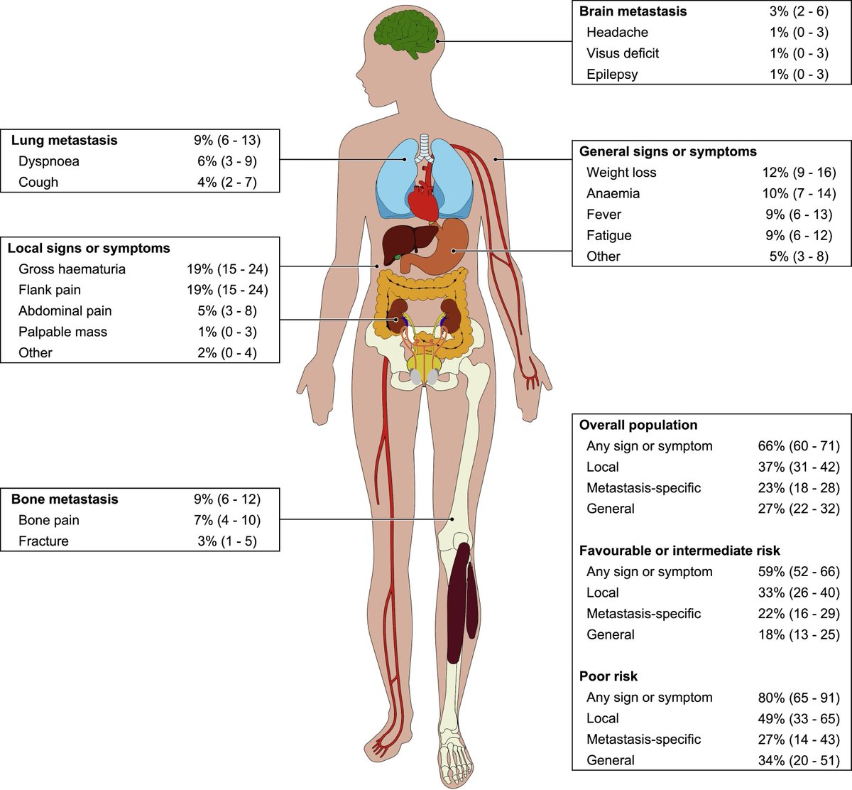 European Urology (@euplatinum) on Twitter photo Cytoreductive Nephrectomy in Metastatic Patients with Signs or Symptoms: Implications for Renal Cell Carcinoma Guidelines
<a href="/_alelarcher/">Alessandro Larcher</a> <a href="/u_capitanio/">Umberto Capitanio</a> <a href="/F_Montorsi/">Francesco Montorsi</a> <a href="/GFallara_MD/">Giuseppe Fallara</a> <a href="/GianmarcoColand/">Gianmarco Colandrea, MD</a>
buff.ly/2BI921g Cytoreductive Nephrectomy in Metastatic Patients with Signs or Symptoms: Implications for Renal Cell Carcinoma Guidelines
<a href="/_alelarcher/">Alessandro Larcher</a> <a href="/u_capitanio/">Umberto Capitanio</a> <a href="/F_Montorsi/">Francesco Montorsi</a> <a href="/GFallara_MD/">Giuseppe Fallara</a> <a href="/GianmarcoColand/">Gianmarco Colandrea, MD</a>
buff.ly/2BI921g
