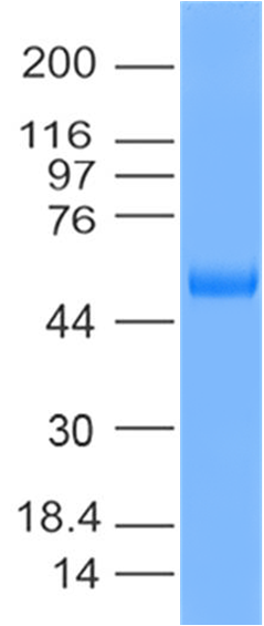 abeomics's tweet photo. Recombinant SARS-Cov-2 Spike RBD Protein Fc Tag (319-541 aa)

For more details about this visit our website - : https://t.co/bFpHF8acvs and follow the web-page : https://t.co/hdrdsCYfoX

#WB https://t.co/jueKteTJnN