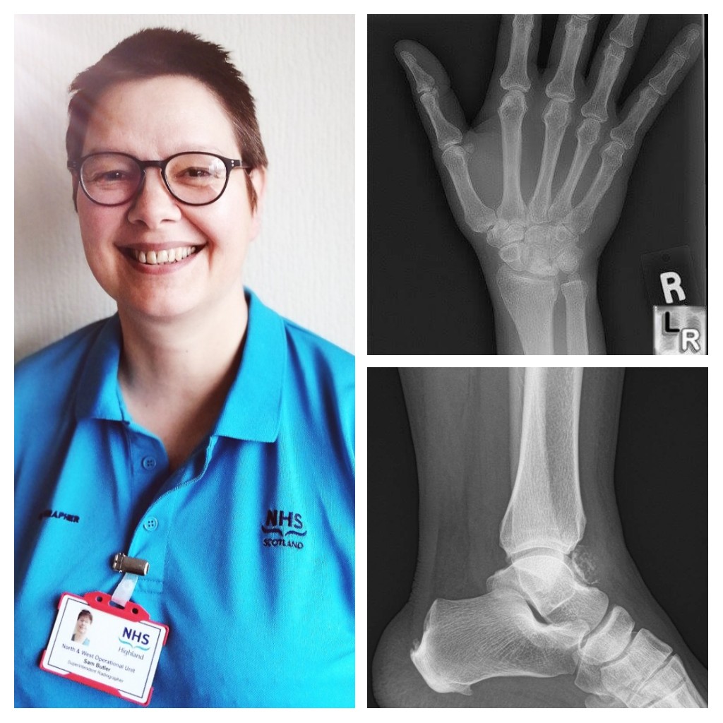 DYWICH's tweet photo. Sam has worked for @NHSHighlands for 35 years and is proud to be #DYWKeyworker
Read what an exciting role she has here โก๏ธhttps://t.co/tXyHCtrb7b
#DYWScot #Ajobforeveryone https://t.co/mAJFkWux5M