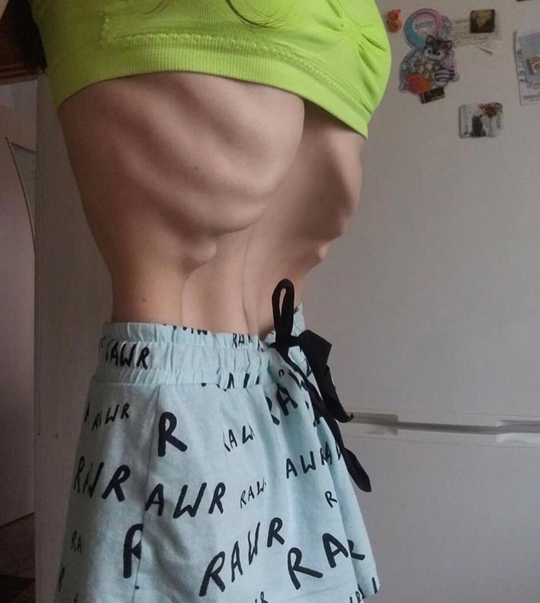 to_the_bone19's tweet photo. NOT MY PICTURE- this is absolute body goals 😍 

 #anorexia #anorexic #bodygoals  #thinspo #anorexic #anorexia #needtolooseweight #weightlossjourney #instazero #weightlossjourney #EDtwt https://t.co/i09Zn6HMh6