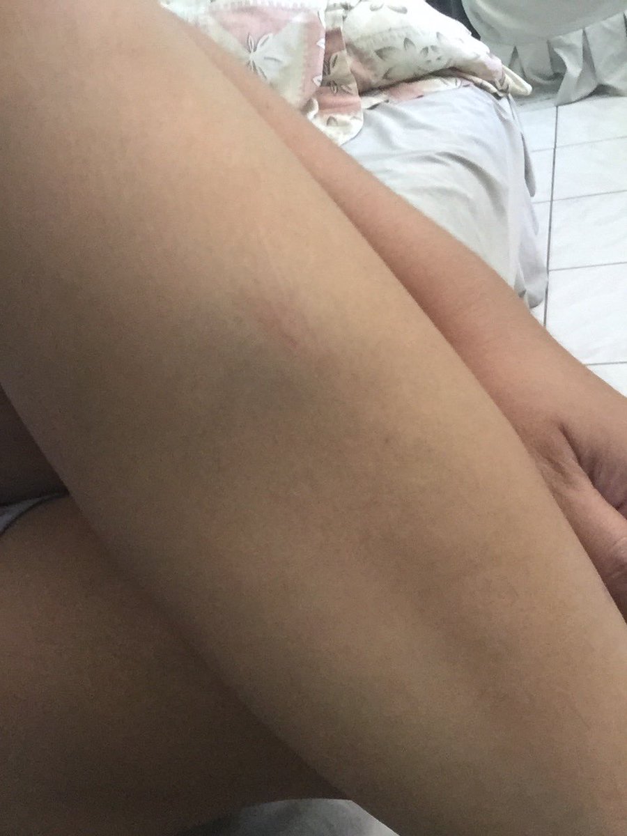 trixcyjhoi's tweet photo. Motor accident 😔 https://t.co/mY2UXyIbuy