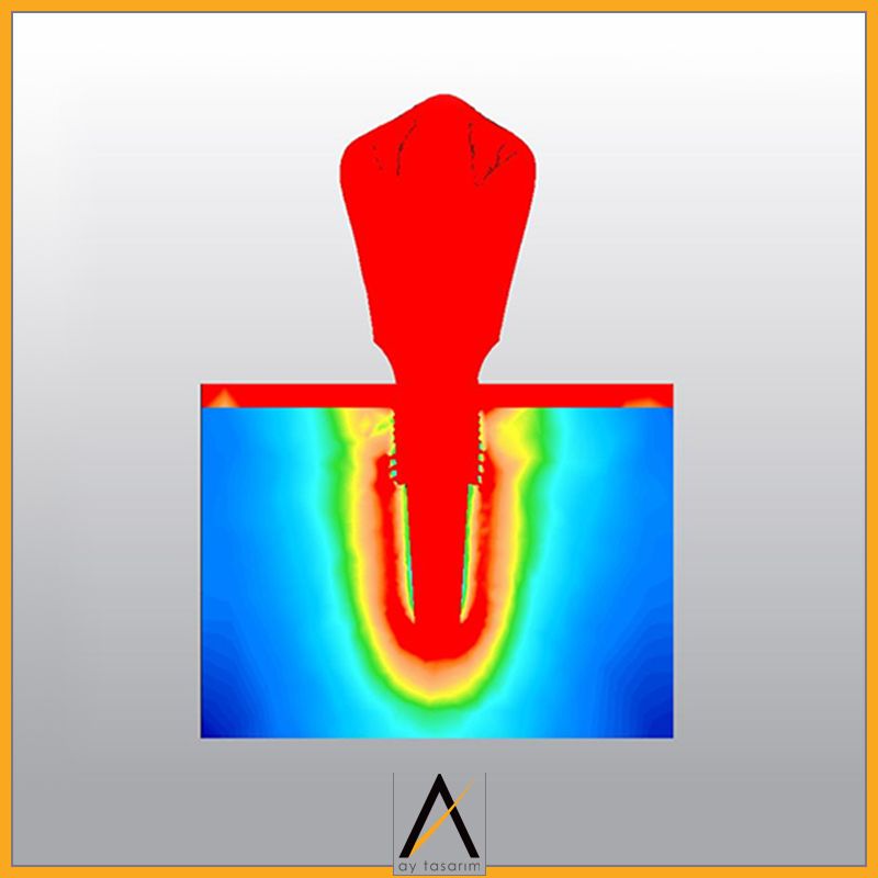 aytasarim's tweet photo. Çalışma Adı: Mandibula posterior implant biyomekaniği: sonlu eleman analizi
Doktor Adı: Direnç Ulaşan

#digitaldentistry #implant #runyes #realguide #freeshape120 #dijitaldishekimligi  #dikissizcerrahi #finiteelementanalysis #sonluelemananalizi #FEM #FEA #SEA #SEM #mandible https://t.co/oUBh9G2ZnR